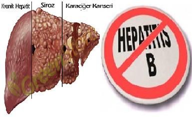 Hepatit virusundan necə qurtulmalı?  ARAŞDIRMA